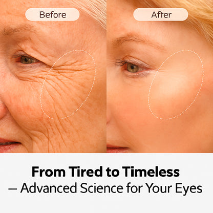 Temporary Eye Tightener