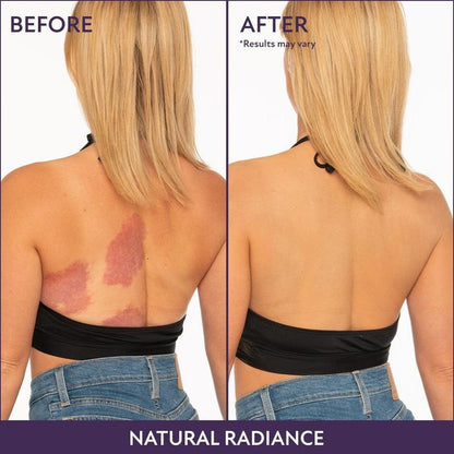 Body Perfector Coverage